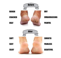 Silicon Gel Pad Heel Protector Socks